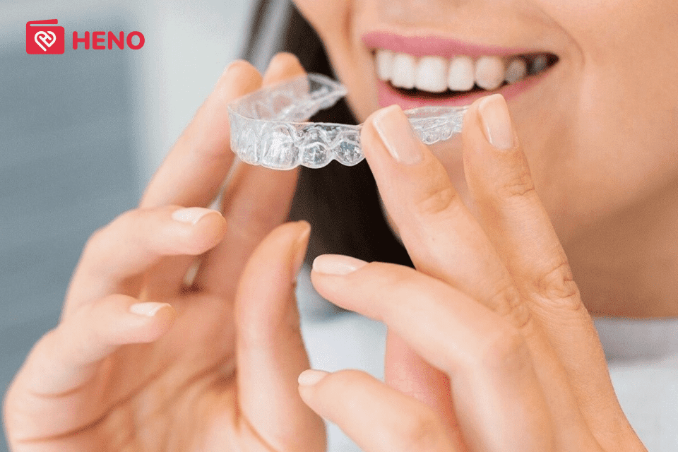 Niềng răng trong suốt mất bao lâu mới thấy được hiệu quả?